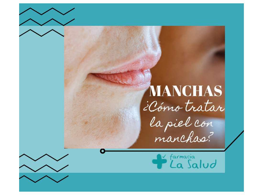 Manchas en la piel